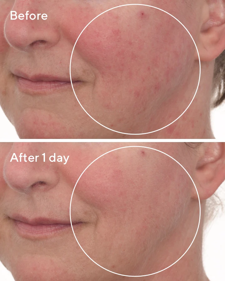 Cellular Hydration Barrier Repair Sleep Mask