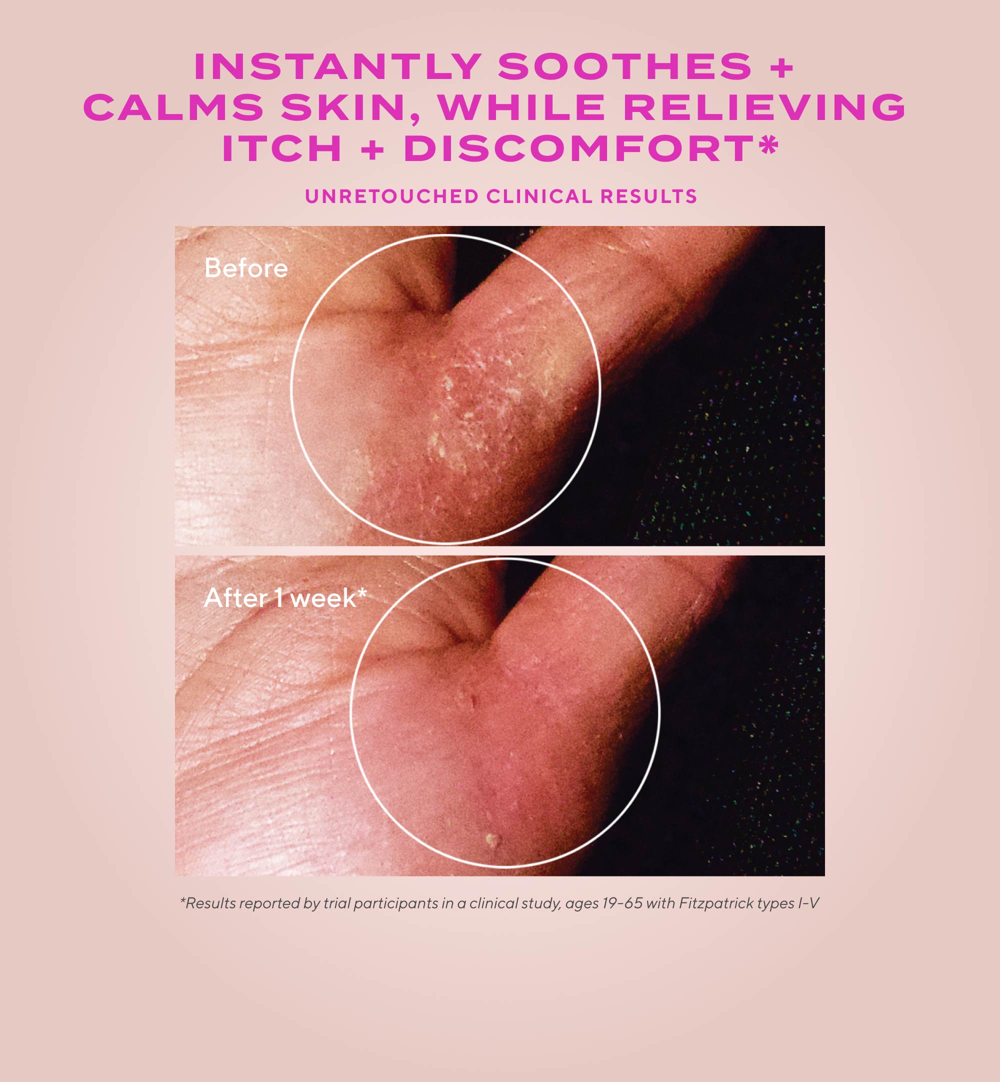 Quick Relief Moisture Treatment