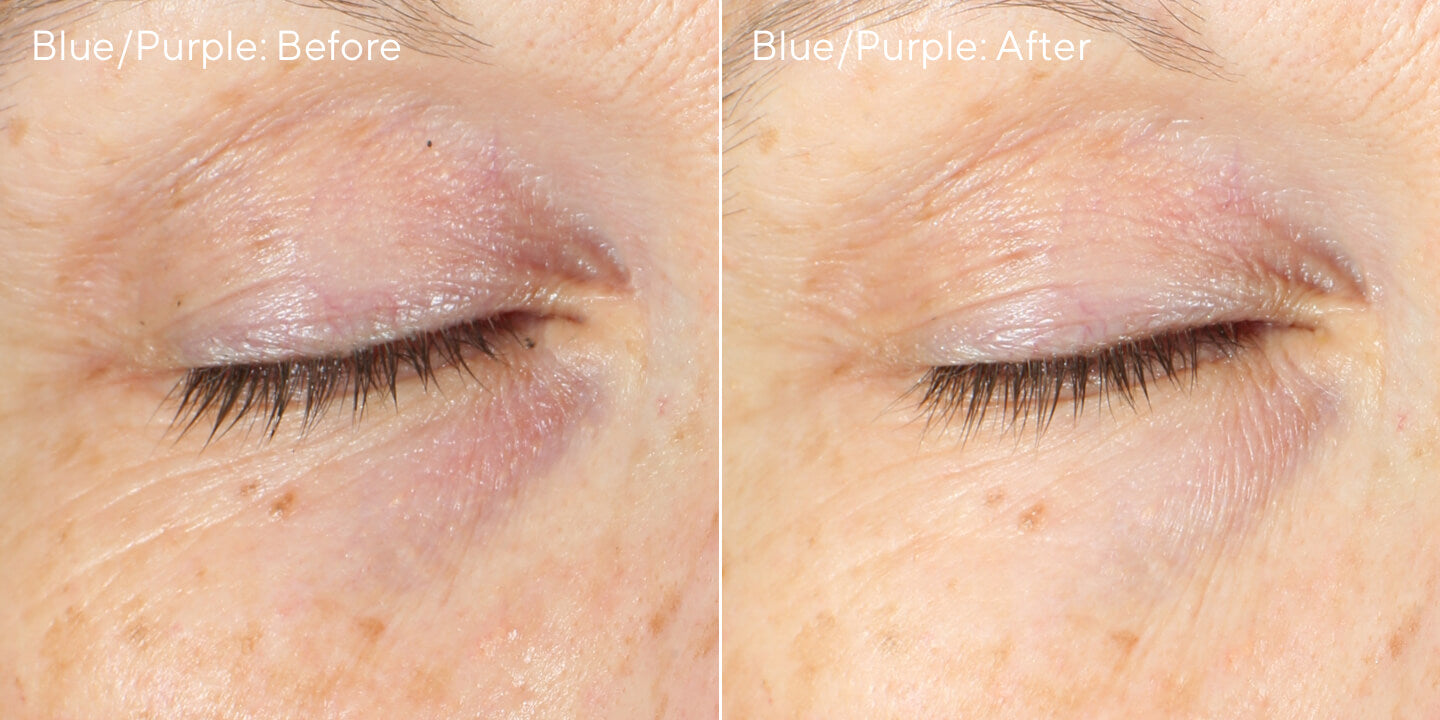 Vita-C Dark Circle Corrector BnAs