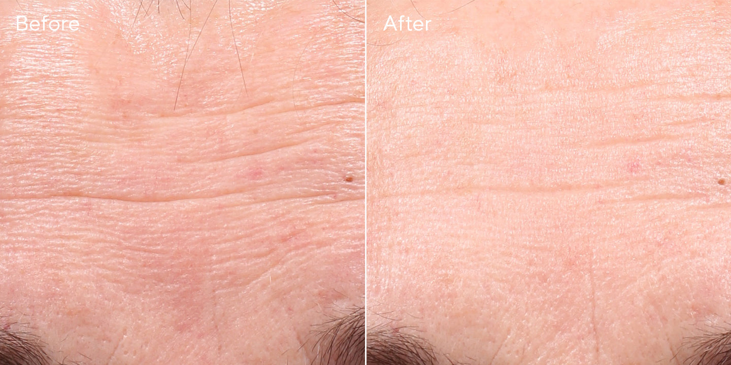 BAs_RETINOL_YOUTH_RENEWAL_SERUM