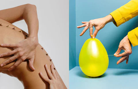 How Do You Get Rid of Acne... And How Do You Get It In The First Place?