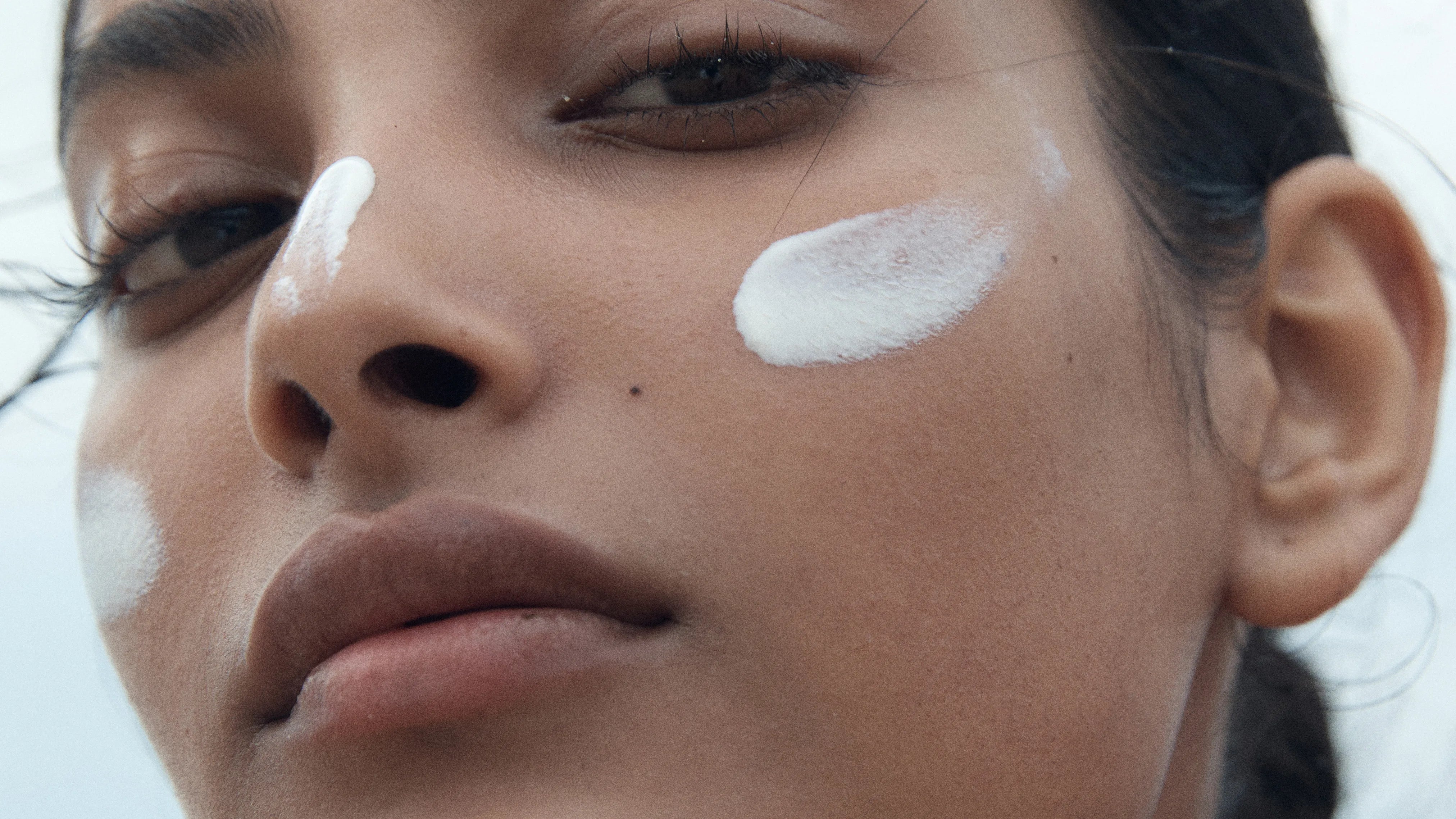 Why Sunscreen is Essential in Managing Melasma Daily