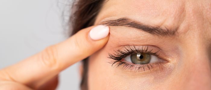 How to Lift Droopy Eyelids Without Surgery: Skincare Tips That Work