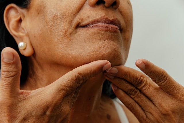 How Collagen Loss During Menopause Affects Skin Elasticity and Wrinkles