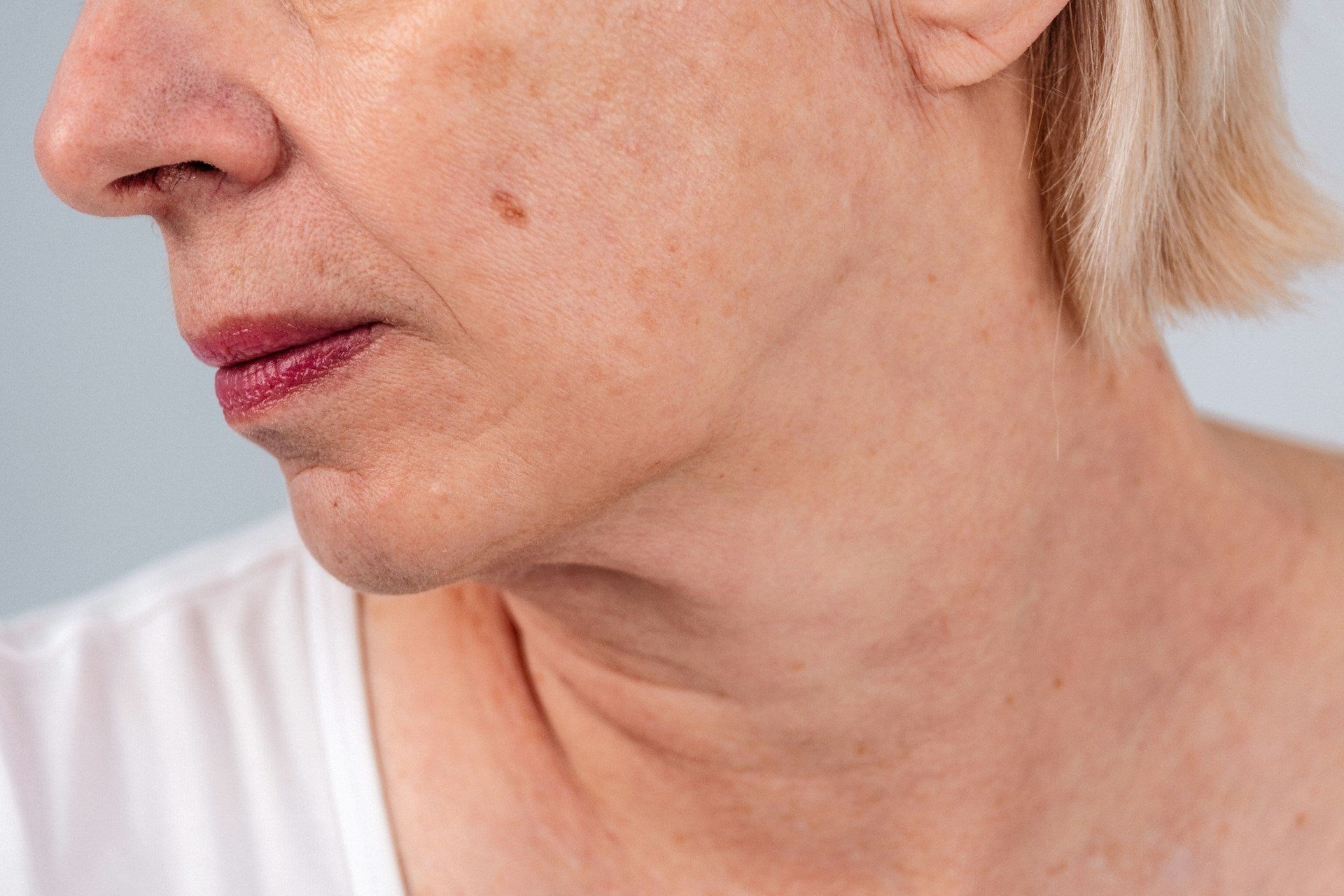 Perimenopause Skin Problems Explained: From Sensitivity to Sudden Pigmentation