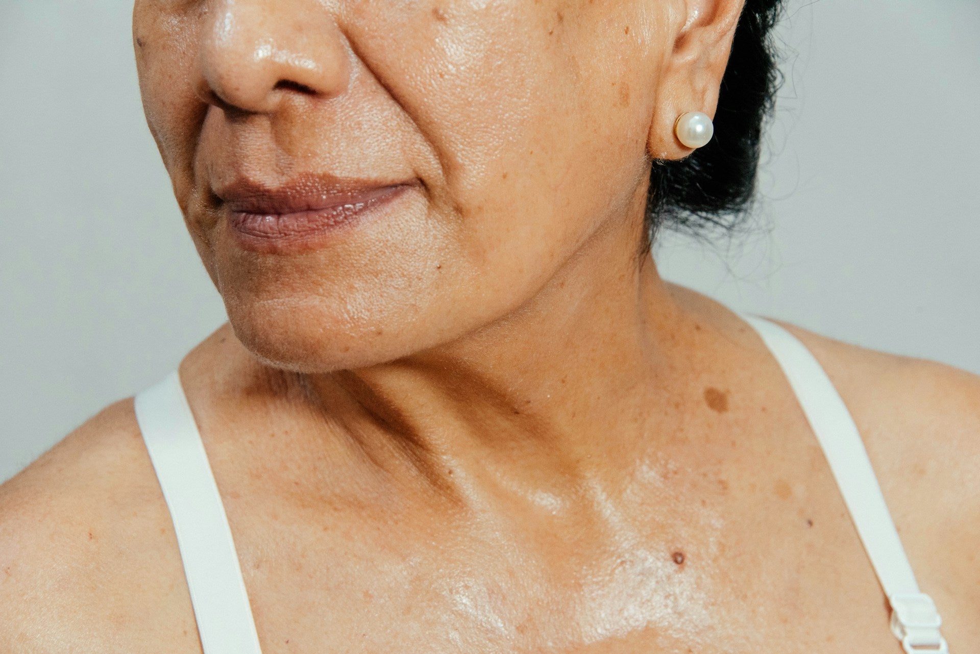 Menopause Skincare Trends 2026: Ingredients & Treatments Dermatologists Recommend