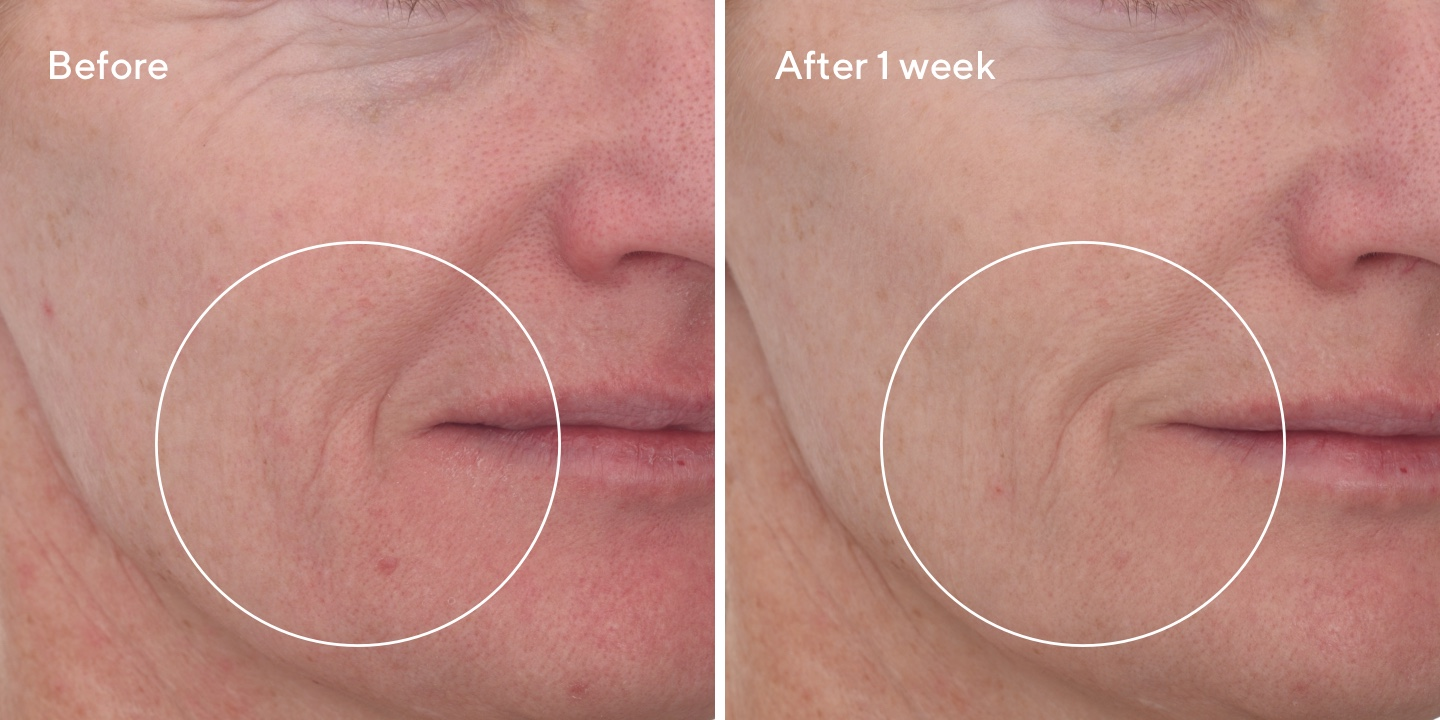 2023 Dec Cellular Hydration Barrier Repair Cream B&A 1