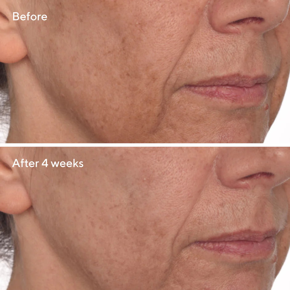 Vita-C Glycolic Serum Travel Size