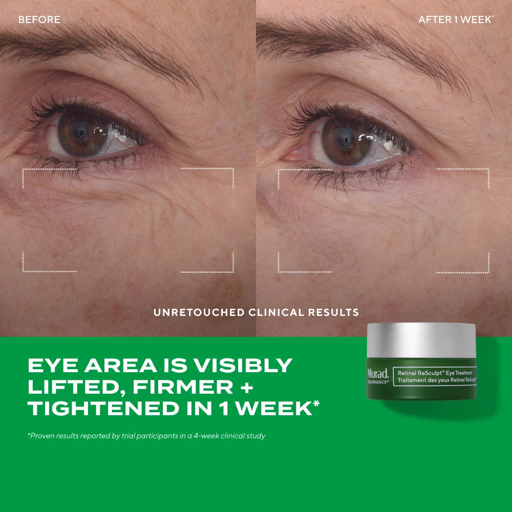 Retinal ReSculpt Eye Lift Treatment Before and After