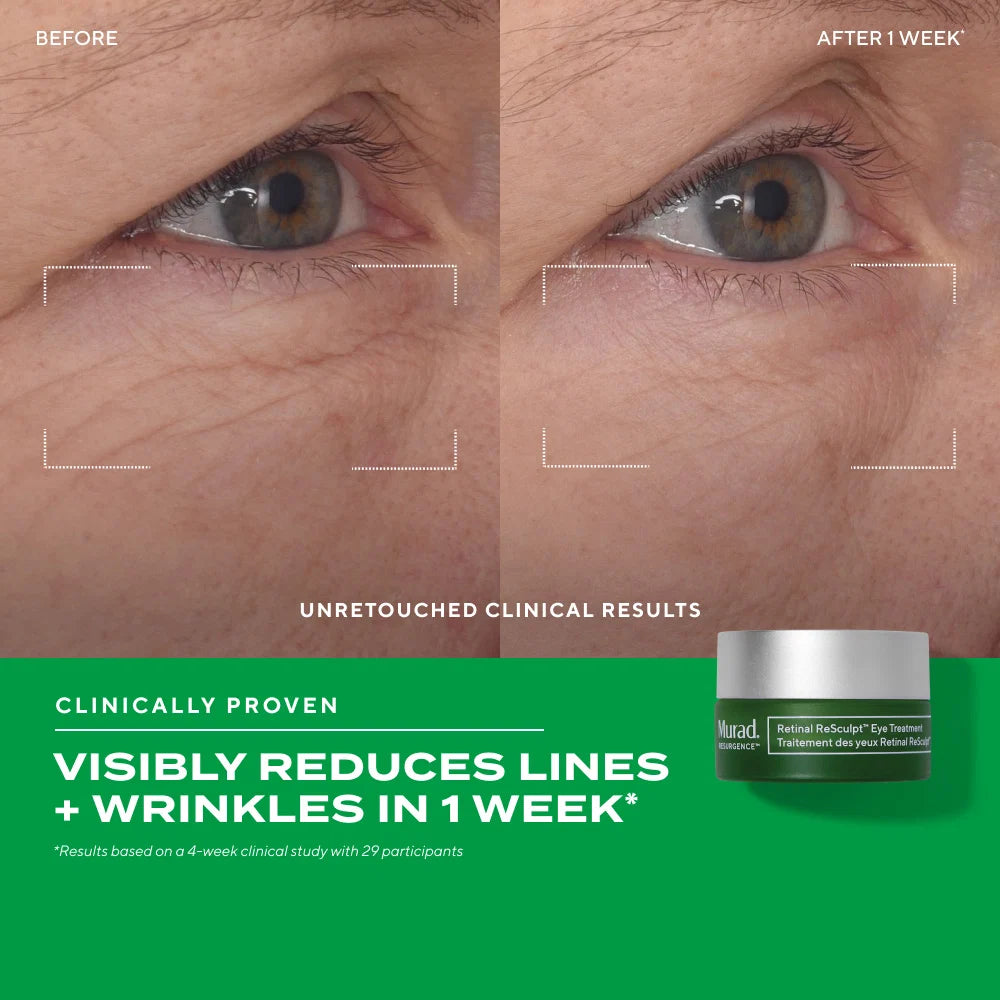 Retinal ReSculpt Eye Lift Treatment Before and After