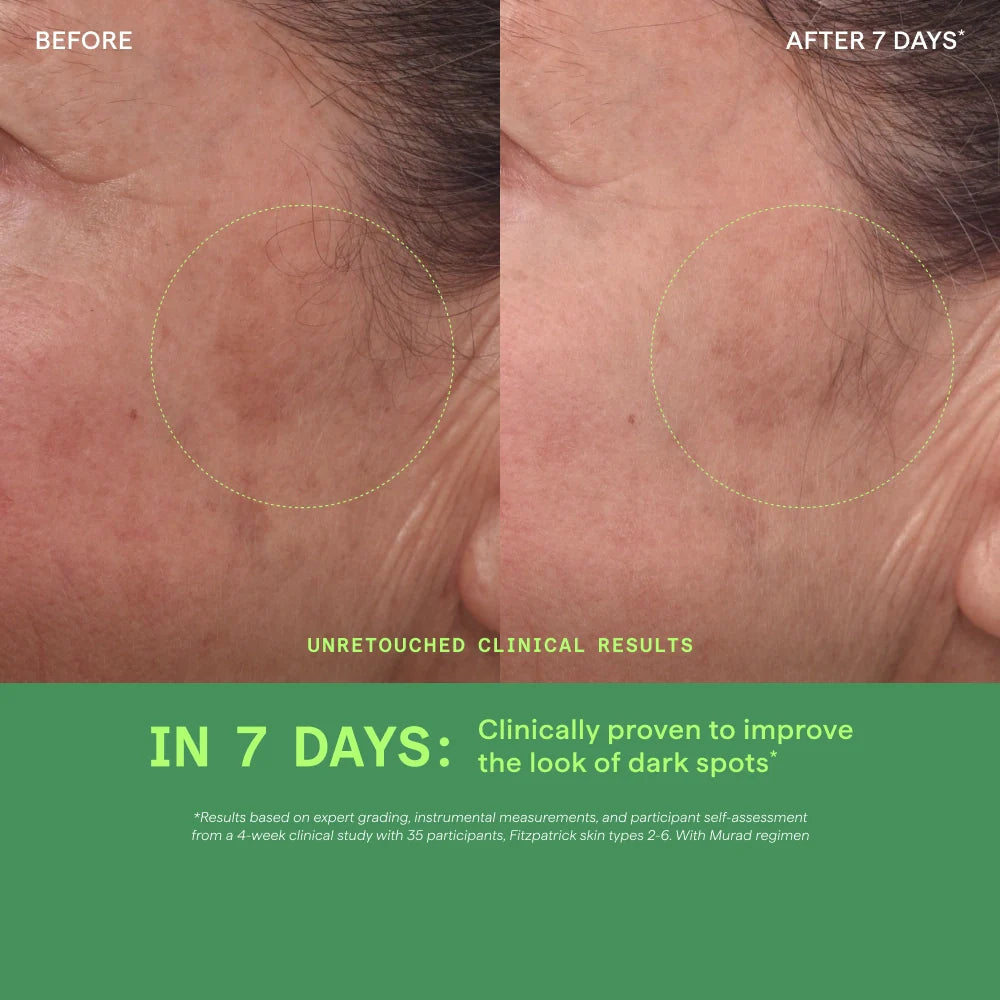 Rapid Dark Spot Correcting Serum