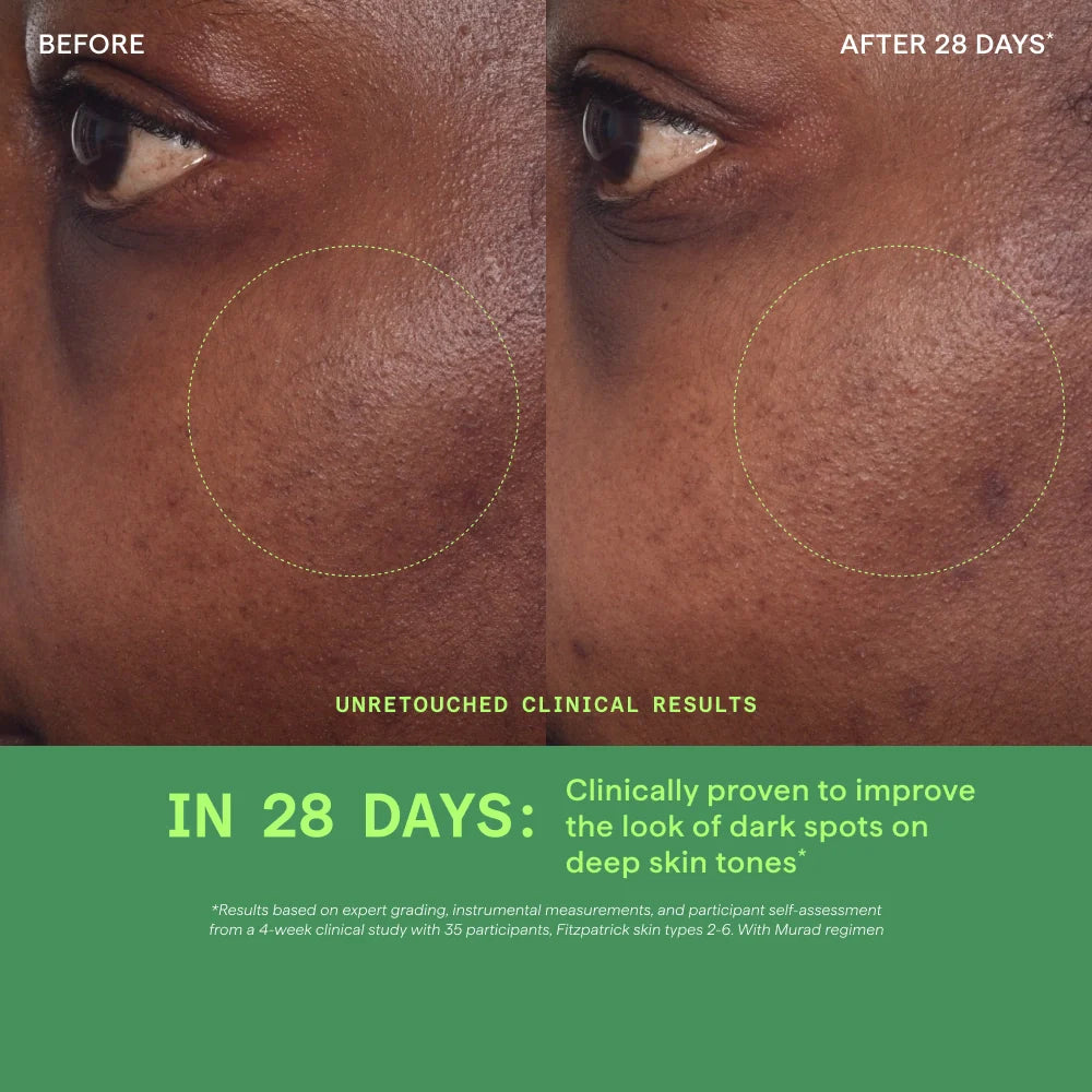 Rapid Dark Spot Correcting Serum