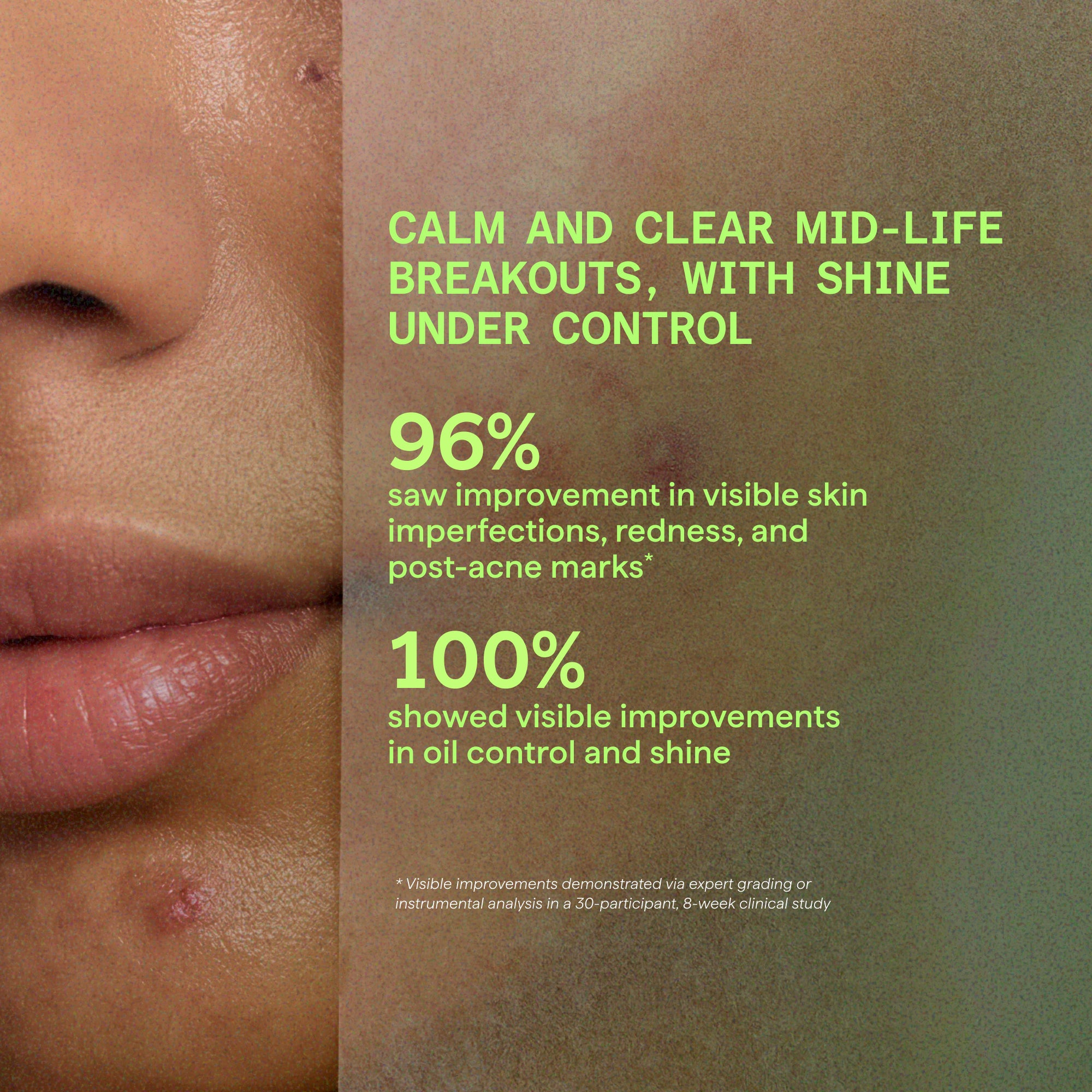 Murad Biome-Balancing Calm & Recover Cream moisturiser for hormonal breakouts and perimenopause skin results