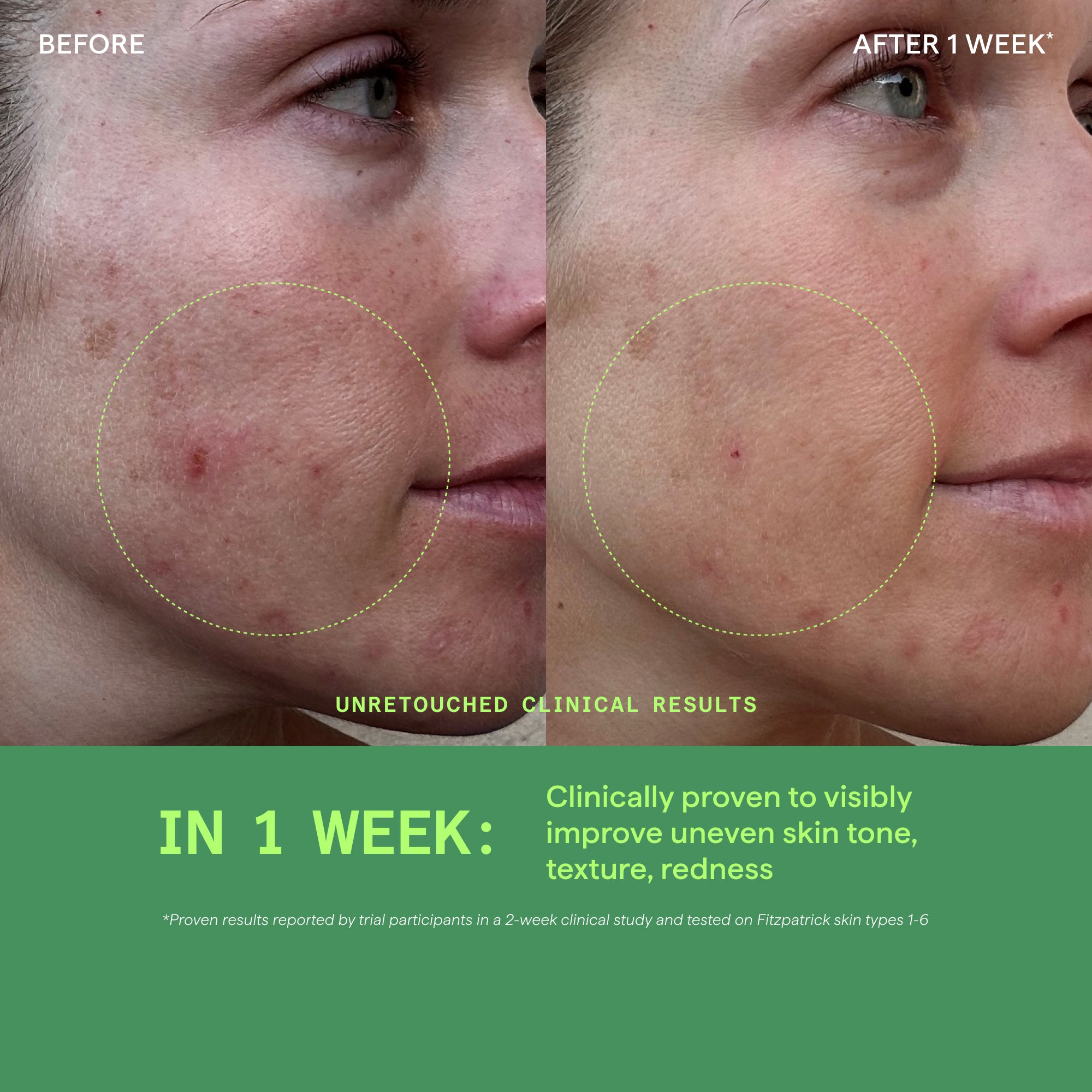Murad Biome-Balancing Calm & Recover Cream moisturiser for hormonal breakouts and perimenopause skin before and afters
