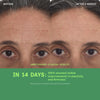 New Retinol Youth Renewal Serum before and after