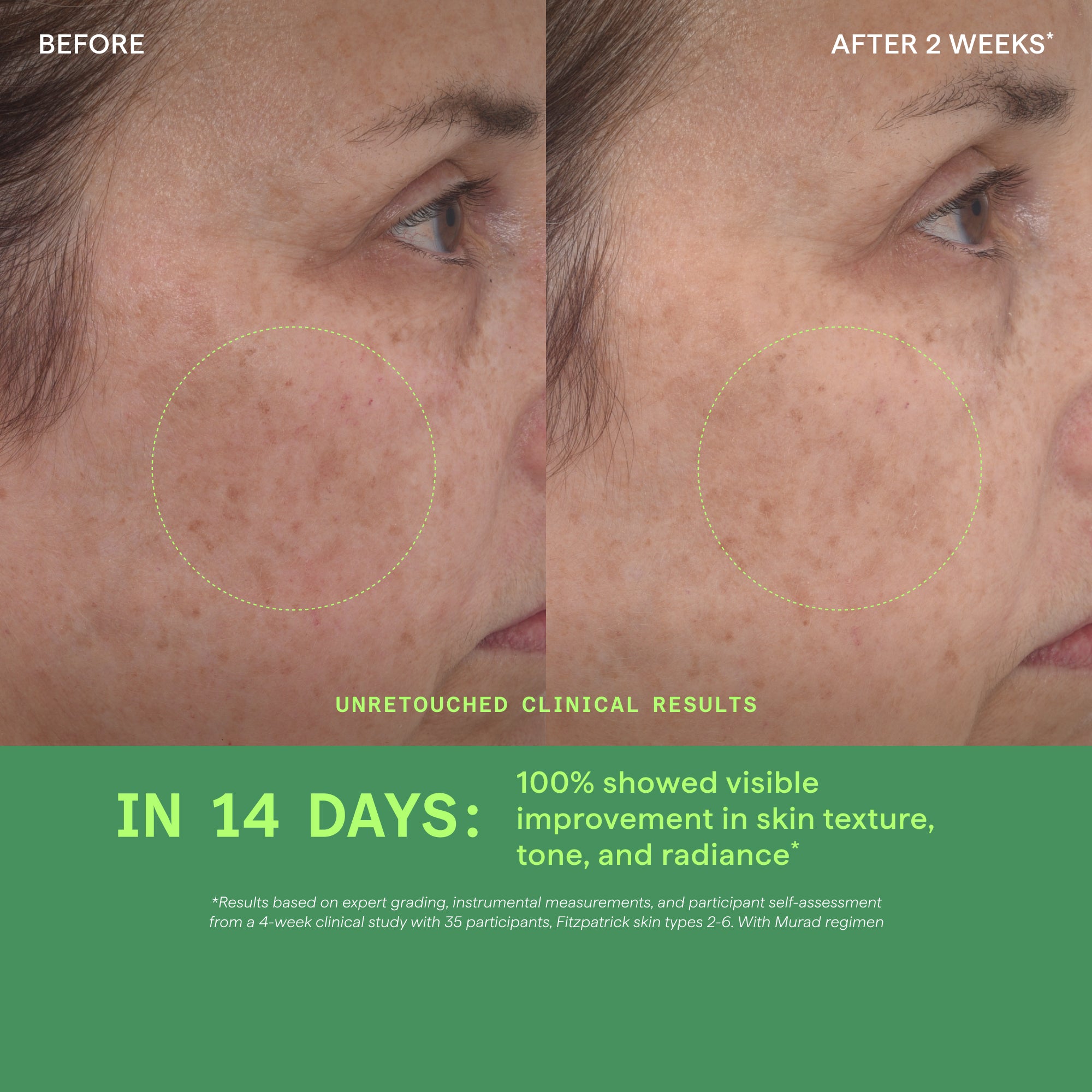 New Retinol Youth Renewal Serum