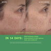 New Retinol Youth Renewal Serum before and after