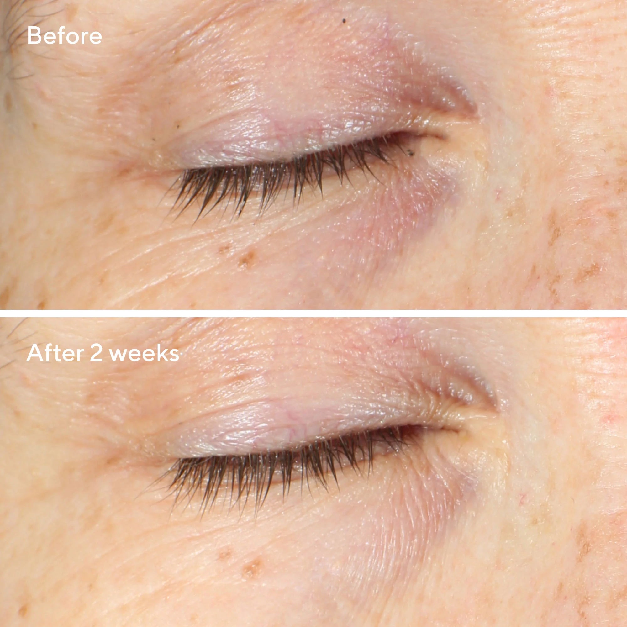 Murad Vita-C Eyes Dark Circle Corrector Before and After