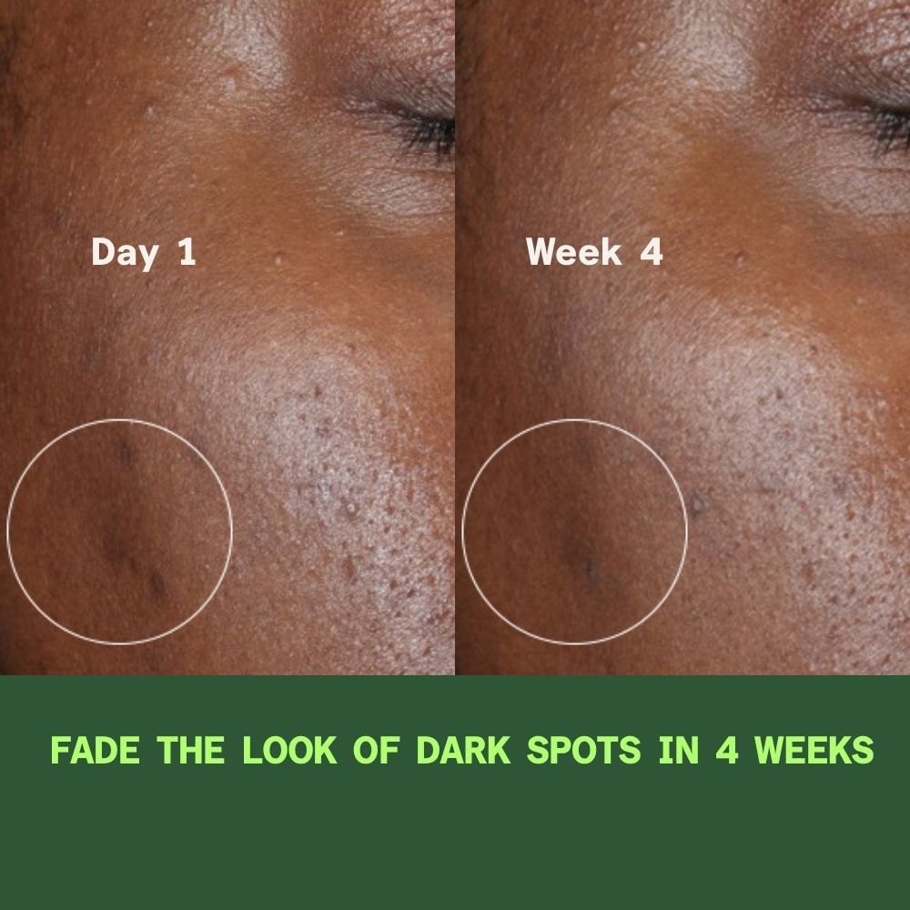Discovery Bundle: Rapid Dark Spot Correcting Serum PLUS Retinol Youth Renewal Serum