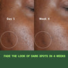 Before and after showing reduction in melasma and dark spots after 4 weeks