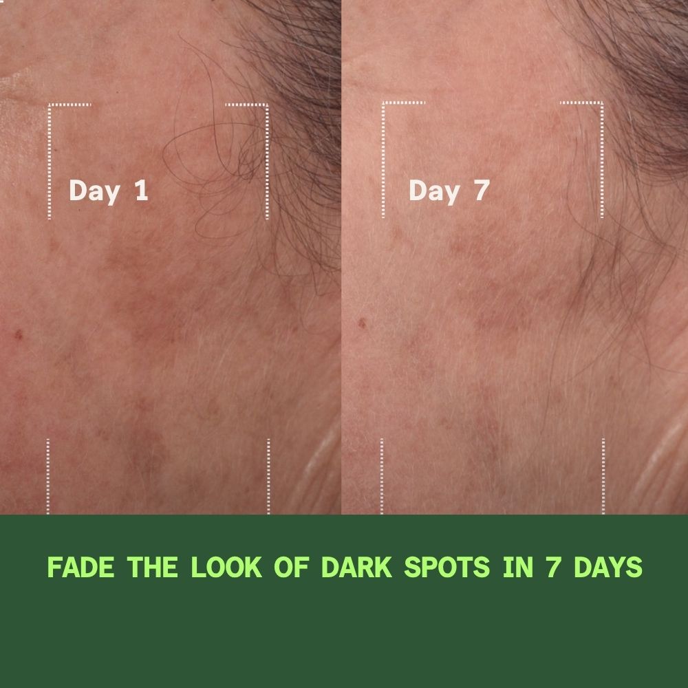 Discovery Bundle: Rapid Dark Spot Correcting Serum PLUS Retinol Youth Renewal Serum