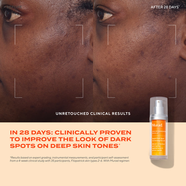Rapid Dark Spot Correcting Serum