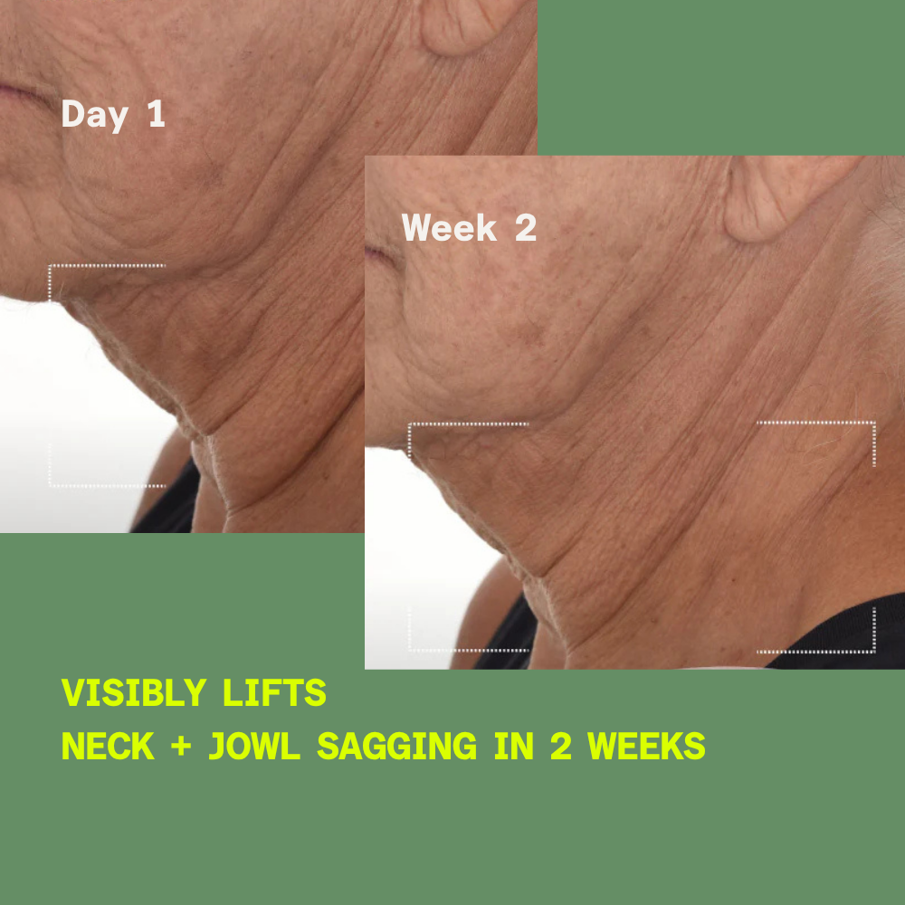 Before and after showing improvement in skin firmness, fine lines and wrinkles after using Retinal ReSculpt Overnight Treatment