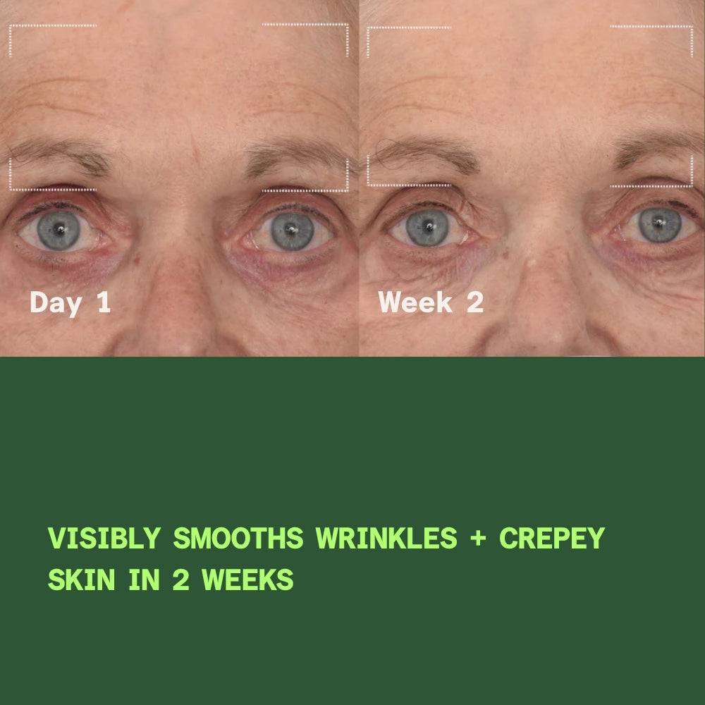 Before and after comparison of a person's eye area with text indicating skin improvement over 2 weeks.