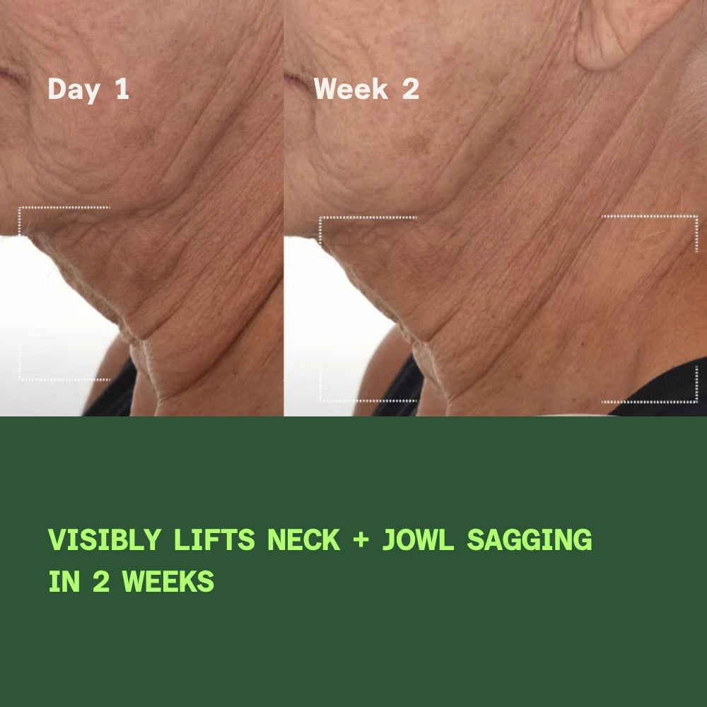 Before and after showing improvement in skin firmness, fine lines and wrinkles after using Retinal ReSculpt Overnight Treatment